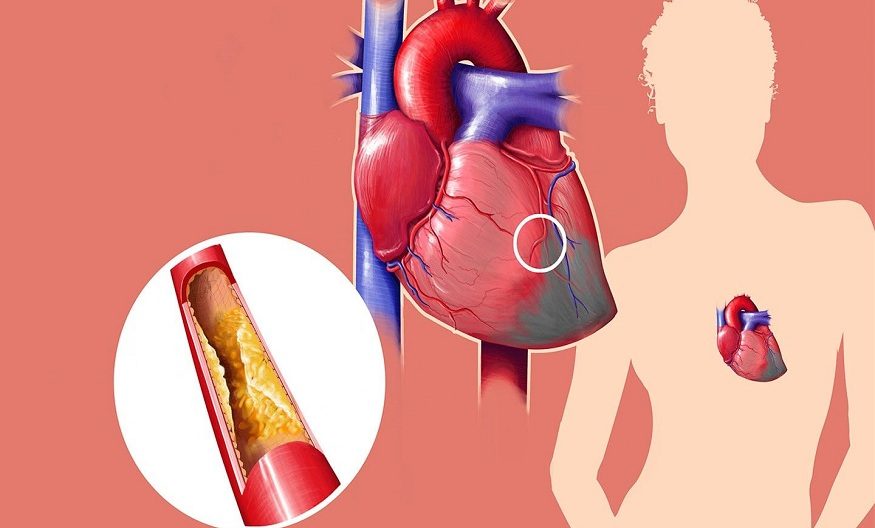 know about cholesterol